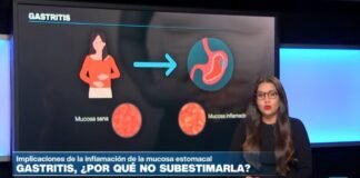 ¿Por qué no debemos subestimar la gastritis?